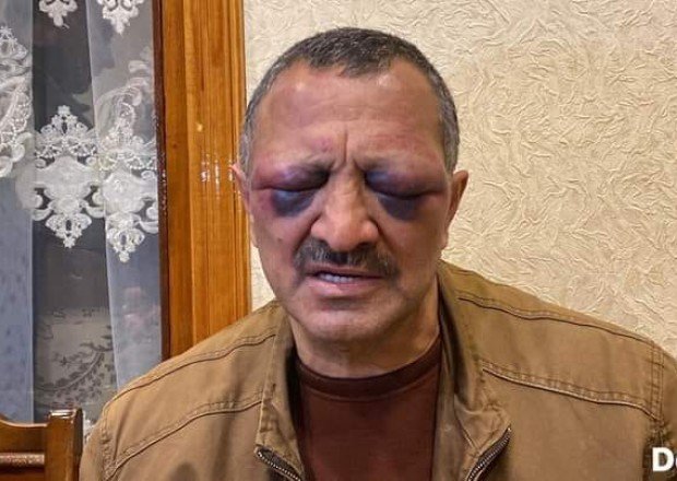 Tofiq Yaqublu xəstəxanaya aparıldı -