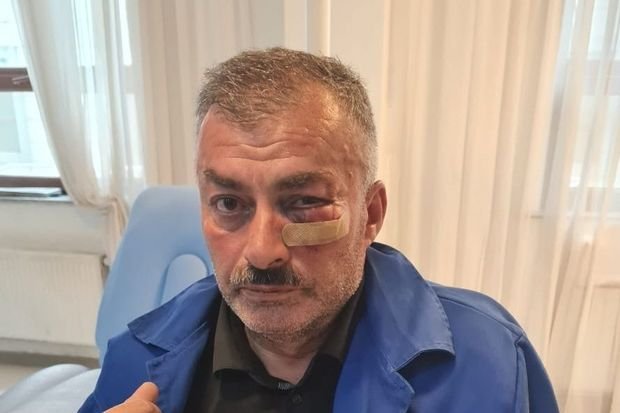 Borclu abonent “Azəriqaz”ın işçilərini yaba ilə hədələdi -