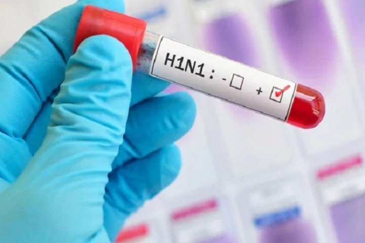 Donuz qripi ilə bağlı epidemioloji vəziyyət diqqətlə izlənilir -