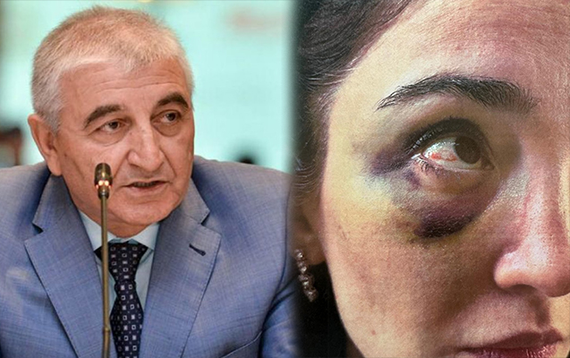 Məzahir Pənahovun oğlu hamilə arvadını vəhşicəsinə döyüb –